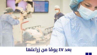 نيويورك تايمز: إزالة كلية خنزير من مريضة بسبب تدفق الدم غير الكافي