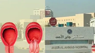 سرطان البروستاتا